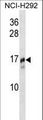 TRAPPC2 / SEDL Antibody - TRAPPC2 Antibody western blot of NCI-H292 cell line lysates (35 ug/lane). The TRAPPC2 antibody detected the TRAPPC2 protein (arrow).