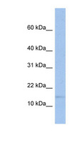 TRAPPC2 / SEDL Antibody - TRAPPC2 antibody Western blot of Fetal Spleen lysate. This image was taken for the unconjugated form of this product. Other forms have not been tested.