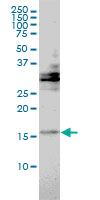 TRAPPC2 / SEDL Antibody - TRAPPC2 monoclonal antibody (M01), clone 2E10 Western Blot analysis of TRAPPC2 expression in HeLa.