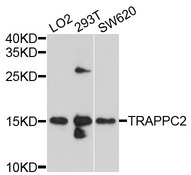TRAPPC2 / SEDL Antibody - Western blot analysis of extracts of various cell lines, using TRAPPC2 antibody at 1:1000 dilution. The secondary antibody used was an HRP Goat Anti-Rabbit IgG (H+L) at 1:10000 dilution. Lysates were loaded 25ug per lane and 3% nonfat dry milk in TBST was used for blocking. An ECL Kit was used for detection and the exposure time was 5s.