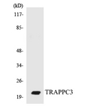 TRAPPC3 Antibody - Western blot analysis of the lysates from COLO205 cells using TRAPPC3 antibody.