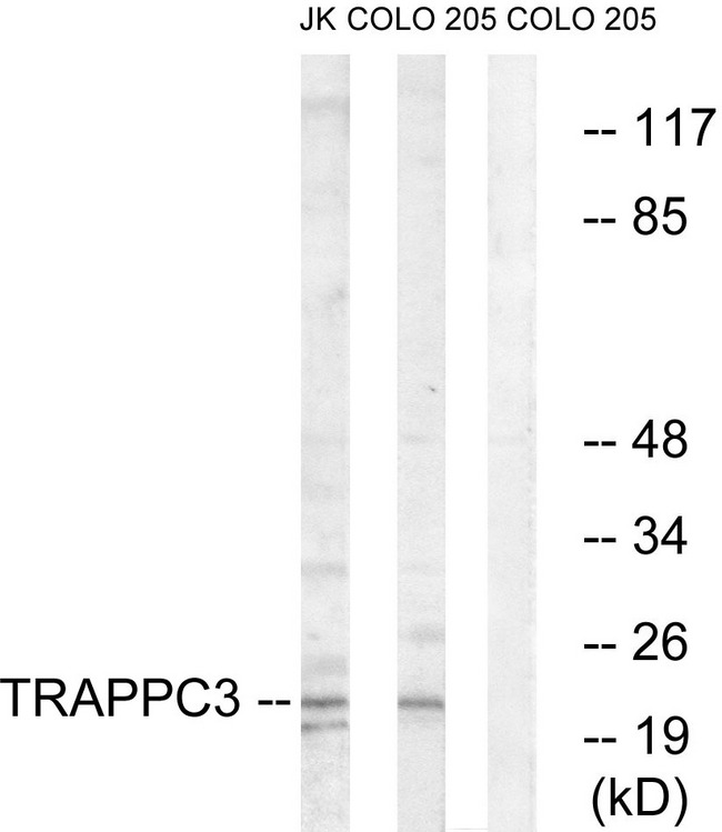 TRAPPC3 Antibody - Western blot analysis of lysates from COLO and Jurkat cells, using TRAPPC3 Antibody. The lane on the right is blocked with the synthesized peptide.