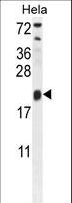 TRAPPC3 Antibody - TRAPPC3 Antibody western blot of HeLa cell line lysates (35 ug/lane). The TRAPPC3 antibody detected the TRAPPC3 protein (arrow).