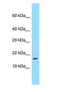 TRAPPC3 Antibody - TRAPPC3 antibody Western Blot of Placenta.  This image was taken for the unconjugated form of this product. Other forms have not been tested.