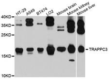 TRAPPC3 Antibody - Western blot analysis of extracts of various cells.