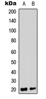 TRAPPC3 Antibody - Western blot analysis of TRAPPC3 expression in HepG2 (A); HeLa (B) whole cell lysates.
