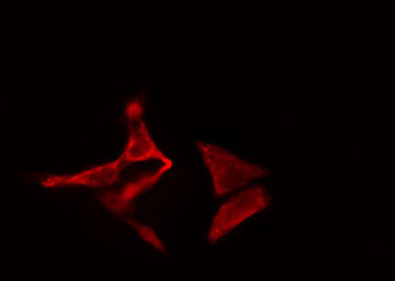 TRAPPC3 Antibody - Staining COLO205 cells by IF/ICC. The samples were fixed with PFA and permeabilized in 0.1% Triton X-100, then blocked in 10% serum for 45 min at 25°C. The primary antibody was diluted at 1:200 and incubated with the sample for 1 hour at 37°C. An Alexa Fluor 594 conjugated goat anti-rabbit IgG (H+L) antibody, diluted at 1/600, was used as secondary antibody.