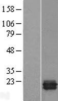 TRAPPC3 Protein - Western validation with an anti-DDK antibody * L: Control HEK293 lysate R: Over-expression lysate