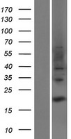 TRAPPC3L / BET3L Protein - Western validation with an anti-DDK antibody * L: Control HEK293 lysate R: Over-expression lysate