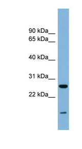 TRAPPC4 / Synbindin Antibody - TRAPPC4 antibody Western blot of Fetal Heart lysate. This image was taken for the unconjugated form of this product. Other forms have not been tested.