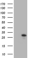 TRAPPC4 / Synbindin Antibody - HEK293T cells were transfected with the pCMV6-ENTRY control (Left lane) or pCMV6-ENTRY TRAPPC4 (Right lane) cDNA for 48 hrs and lysed. Equivalent amounts of cell lysates (5 ug per lane) were separated by SDS-PAGE and immunoblotted with anti-TRAPPC4.
