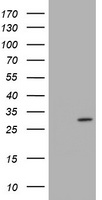 TRAPPC4 / Synbindin Antibody - HEK293T cells were transfected with the pCMV6-ENTRY control (Left lane) or pCMV6-ENTRY TRAPPC4 (Right lane) cDNA for 48 hrs and lysed. Equivalent amounts of cell lysates (5 ug per lane) were separated by SDS-PAGE and immunoblotted with anti-TRAPPC4.