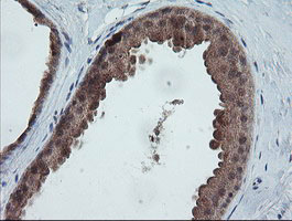 TRAPPC4 / Synbindin Antibody - IHC of paraffin-embedded Human breast tissue using anti-TRAPPC4 mouse monoclonal antibody.