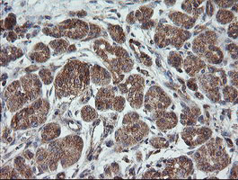 TRAPPC4 / Synbindin Antibody - IHC of paraffin-embedded Human pancreas tissue using anti-TRAPPC4 mouse monoclonal antibody.