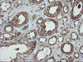 TRAPPC4 / Synbindin Antibody - IHC of paraffin-embedded Human Kidney tissue using anti-TRAPPC4 mouse monoclonal antibody.