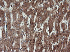 TRAPPC4 / Synbindin Antibody - IHC of paraffin-embedded Human liver tissue using anti-TRAPPC4 mouse monoclonal antibody.