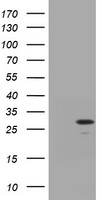 TRAPPC4 / Synbindin Antibody - HEK293T cells were transfected with the pCMV6-ENTRY control (Left lane) or pCMV6-ENTRY TRAPPC4 (Right lane) cDNA for 48 hrs and lysed. Equivalent amounts of cell lysates (5 ug per lane) were separated by SDS-PAGE and immunoblotted with anti-TRAPPC4.