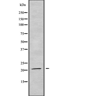 TRAPPC5 Antibody - Western blot analysis of TRAPPC5 using HuvEc whole cells lysates