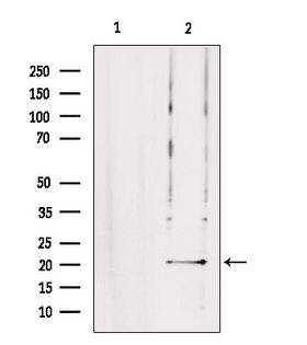 TRAPPC5 Antibody - Western blot analysis of extracts of rat brain tissue using TRAPPC5 antibody. Lane 1 was treated with the blocking peptide.