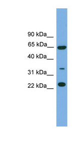 TRAPPC5 Antibody - TRAPPC5 antibody Western blot of HeLa lysate. This image was taken for the unconjugated form of this product. Other forms have not been tested.