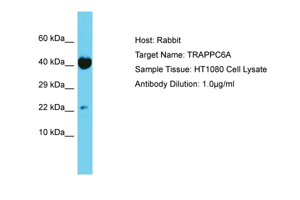 TRAPPC6A Antibody -  This image was taken for the unconjugated form of this product. Other forms have not been tested.