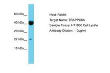 TRAPPC6A Antibody -  This image was taken for the unconjugated form of this product. Other forms have not been tested.