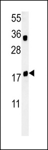 TRAPPC6A Antibody - TPC6A Antibody western blot of Jurkat cell line lysates (35 ug/lane). The TPC6A antibody detected the TPC6A protein (arrow).
