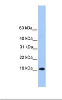 TRAPPC6B Antibody - Hela cell lysate. Antibody concentration: 1.0 ug/ml. Gel concentration: 10%-20%.  This image was taken for the unconjugated form of this product. Other forms have not been tested.