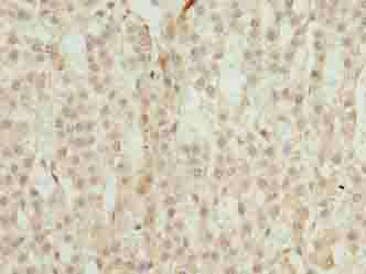 TRAPPC6B Antibody - Immunohistochemistry of paraffin-embedded human adrenal gland tissue using antibody at dilution of 1:100.