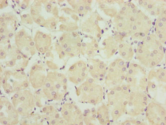 TRAPPC6B Antibody - Immunohistochemistry of paraffin-embedded human pancreatic tissue using TRAPPC6B Antibody at dilution of 1:100