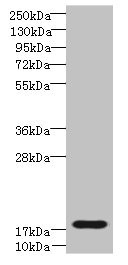 TRAPPC6B Antibody - Western blot All lanes: TRAPPC6B antibody at 4µg/ml + Mouse kidney tissue Secondary Goat polyclonal to rabbit IgG at 1/10000 dilution Predicted band size: 18, 15 kDa Observed band size: 18 kDa