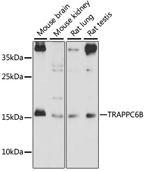 TRAPPC6B Antibody - Western blot analysis of extracts of various cell lines, using TRAPPC6B antibody at 1:1000 dilution. The secondary antibody used was an HRP Goat Anti-Rabbit IgG (H+L) at 1:10000 dilution. Lysates were loaded 25ug per lane and 3% nonfat dry milk in TBST was used for blocking. An ECL Kit was used for detection and the exposure time was 90s.