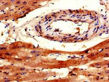 TRAPPC9 Antibody - Immunohistochemistry of paraffin-embedded human heart tissue using TRAPPC9 Antibody at dilution of 1:100