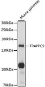 TRAPPC9 Antibody - Western blot analysis of extracts of mouse pancreas, using TRAPPC9 antibody at 1:1000 dilution. The secondary antibody used was an HRP Goat Anti-Rabbit IgG (H+L) at 1:10000 dilution. Lysates were loaded 25ug per lane and 3% nonfat dry milk in TBST was used for blocking. An ECL Kit was used for detection and the exposure time was 1s.