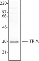 TRAT1 / TRIM Antibody - Extracts from peripheral blood mononuclear cells were resolved by electrophoresis, transferred to nitrocellulose, and probed with mouse monoclonal antibody against TRIM. Proteins were visualized using a goat anti-mouse secondary conjugated to HRP and a ch