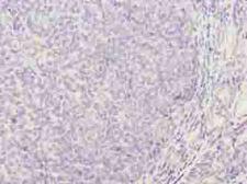 TRAT1 / TRIM Antibody - Immunohistochemistry of paraffin-embedded human tonsil tissue using antibody at dilution of 1:100.
