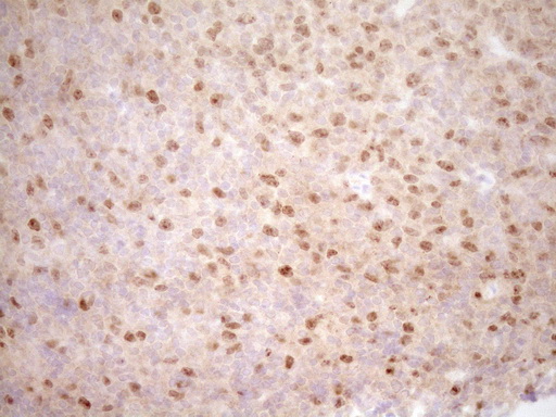 TRB3 / TRIB3 Antibody - IHC of paraffin-embedded Human lymph node tissue using anti-TRIB3 mouse monoclonal antibody. (Heat-induced epitope retrieval by 1 mM EDTA in 10mM Tris, pH8.5, 120°C for 3min).