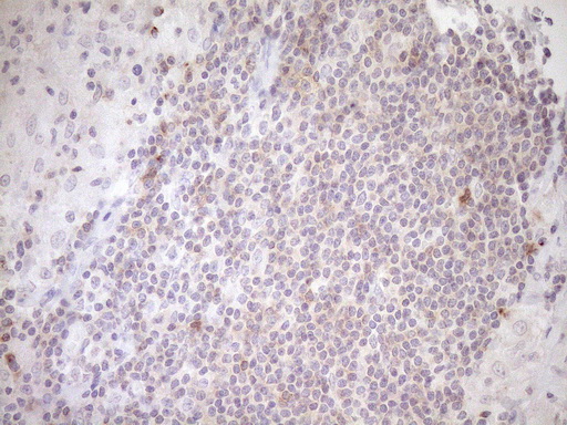 TRB3 / TRIB3 Antibody - Immunohistochemical staining of paraffin-embedded Human lymph node tissue within the normal limits using anti-TRIB3 mouse monoclonal antibody. (Heat-induced epitope retrieval by 1mM EDTA in 10mM Tris buffer. (pH8.5) at 120°C for 3 min. (1:150)