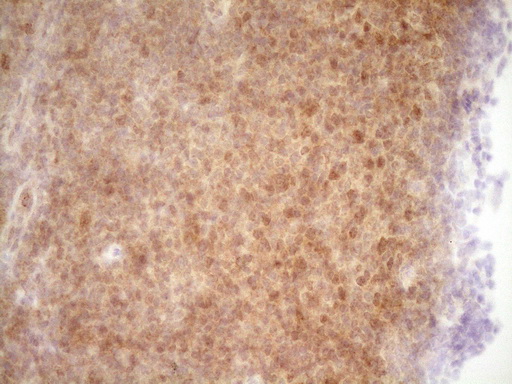 TRB3 / TRIB3 Antibody - Immunohistochemical staining of paraffin-embedded Human lymph node tissue within the normal limits using anti-TRIB3 mouse monoclonal antibody. (Heat-induced epitope retrieval by 1 mM EDTA in 10mM Tris, pH8.5, 120C for 3min,