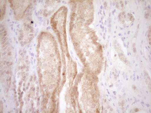 TRB3 / TRIB3 Antibody - Immunohistochemical staining of paraffin-embedded Human Kidney tissue within the normal limits using anti-TRIB3 mouse monoclonal antibody. (Heat-induced epitope retrieval by 1 mM EDTA in 10mM Tris, pH8.5, 120C for 3min,