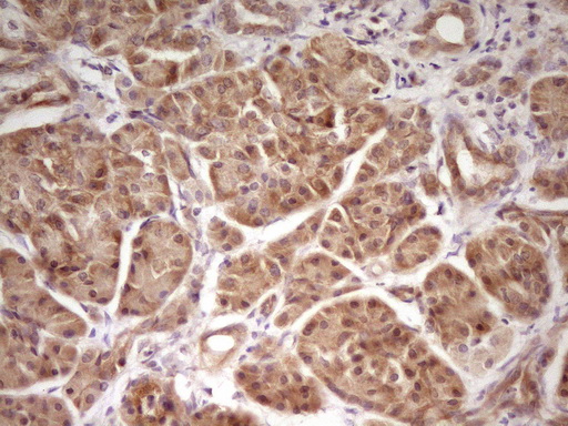 TRB3 / TRIB3 Antibody - Immunohistochemical staining of paraffin-embedded Human pancreas tissue within the normal limits using anti-TRIB3 mouse monoclonal antibody. (Heat-induced epitope retrieval by 1 mM EDTA in 10mM Tris, pH8.5, 120C for 3min,