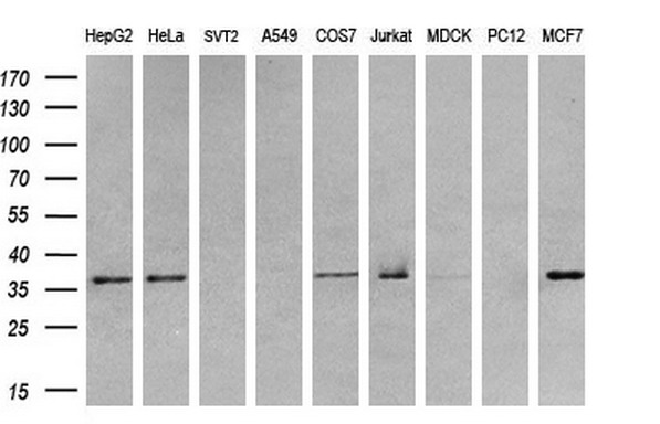 TRB3 / TRIB3 Antibody - Western blot analysis of extracts. (35ug) from 9 different cell lines by using anti-TRIB3 monoclonal antibody. (HepG2: human; HeLa: human; SVT2: mouse; A549: human; COS7: monkey; Jurkat: human; MDCK: canine;rat; MCF7: human). (1:200)