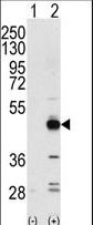 TRB3 / TRIB3 Antibody - Western blot of NPK(arrow) using rabbit polyclonal NPK Antibody. 293 cell lysates (2 ug/lane) either nontransfected (Lane 1) or transiently transfected with the TRIB3 gene (Lane 2) (Origene Technologies).