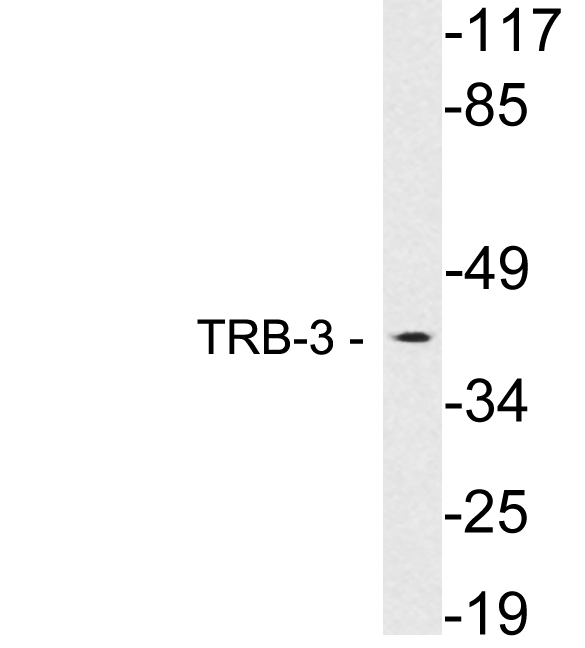 TRB3 / TRIB3 Antibody - Western blot analysis of lysates from HepG2 cells, using TRB-3 antibody.