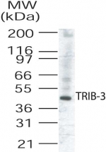 TRB3 / TRIB3 Antibody - Western blot of TRIB3 in human liver lysate .