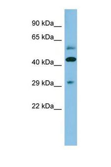 TRB3 / TRIB3 Antibody - Western blot of Human Fetal Kidney. TRIB3 antibody dilution 1.0 ug/ml.  This image was taken for the unconjugated form of this product. Other forms have not been tested.
