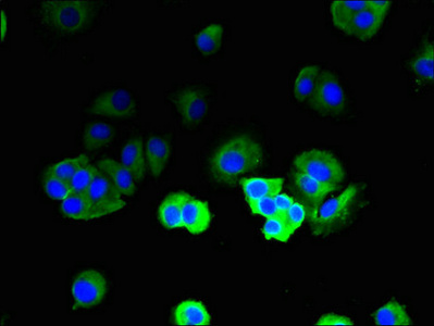 TRBC1 Antibody - Immunofluorescent analysis of MCF-7 cells using TRBC1 Antibody at dilution of 1:100 and Alexa Fluor 488-congugated AffiniPure Goat Anti-Rabbit IgG(H+L)