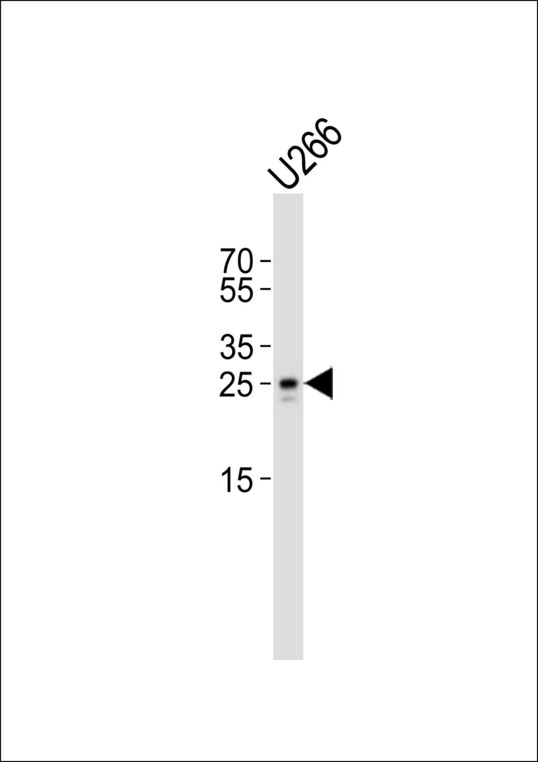TRBC1 Antibody - Western blot of lysate from U266 cell line with TRBC1 Antibody. Antibody was diluted at 1:1000. A goat anti-rabbit IgG H&L (HRP) at 1:10000 dilution was used as the secondary antibody. Lysate at 20 ug.