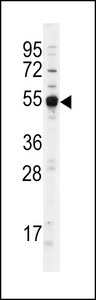 TRDMT1 / DNMT2 Antibody - Western blot of anti-Dnmt2 antibody in Jurkat cell lysate (Lane A) and mouse liver tissue lysate (Lane B). Dnmt2 (arrow) was detected using purified antibody. Secondary HRP-anti-rabbit was used for signal visualization with chemiluminescence.