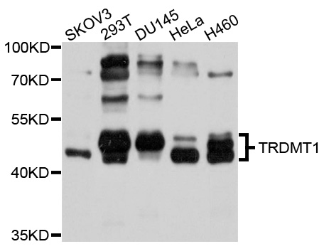 TRDMT1 / DNMT2 Antibody - Western blot analysis of extracts of various cell lines, using TRDMT1 antibody at 1:1000 dilution. The secondary antibody used was an HRP Goat Anti-Rabbit IgG (H+L) at 1:10000 dilution. Lysates were loaded 25ug per lane and 3% nonfat dry milk in TBST was used for blocking. An ECL Kit was used for detection and the exposure time was 5s.
